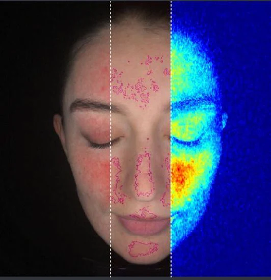 Professional Skin Analysis